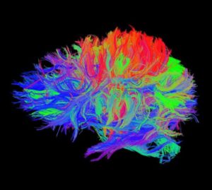Ανθρώπινο μυαλό σε διάφορα χρώματα